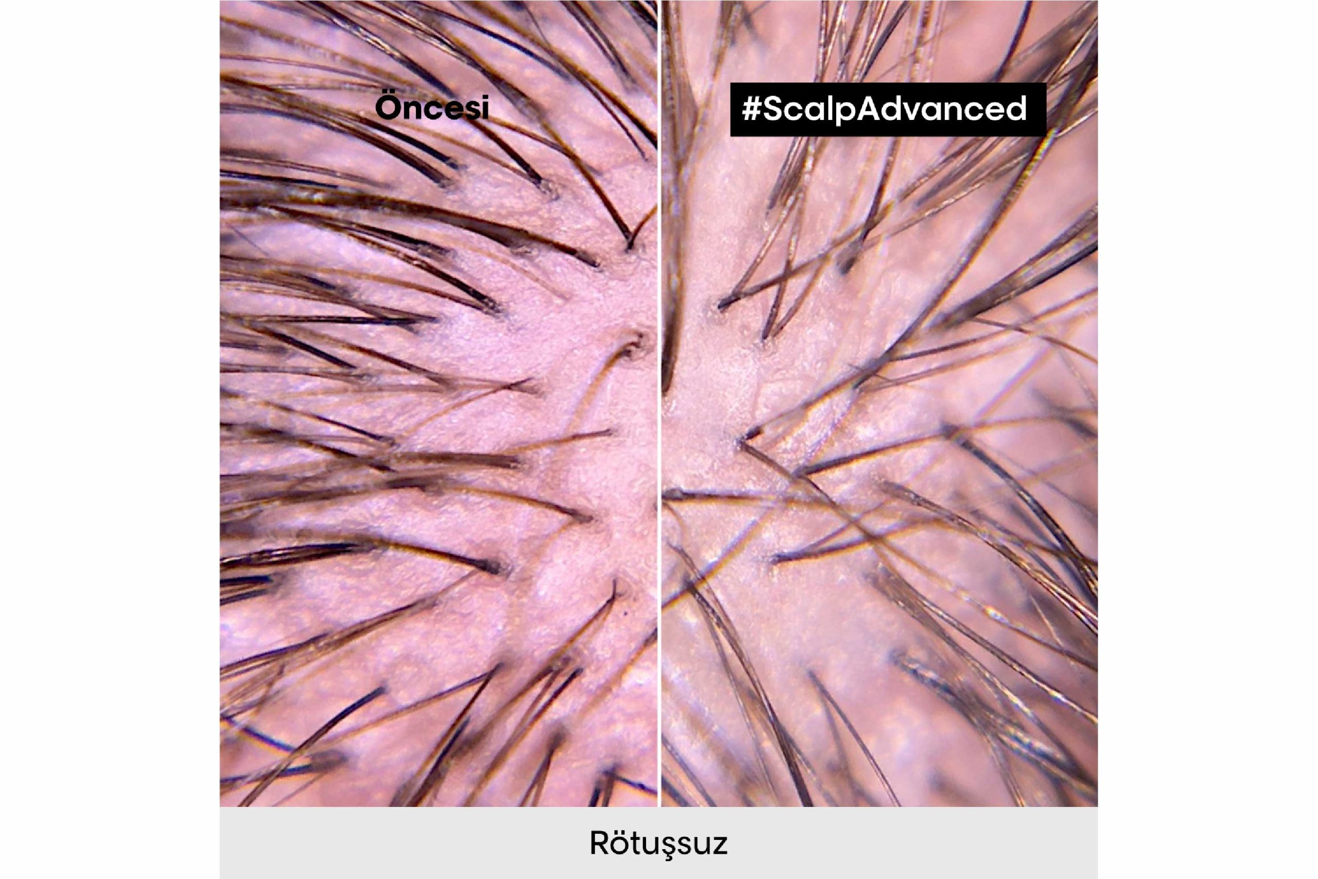 Scalp Advanced Hassas Saç Derisi İçin Profesyonel Şampuan 500ml 2 Scalp Advanced Hassas Saç Derisi İçin Profesyonel Şampuan 500ml - Görsel 2