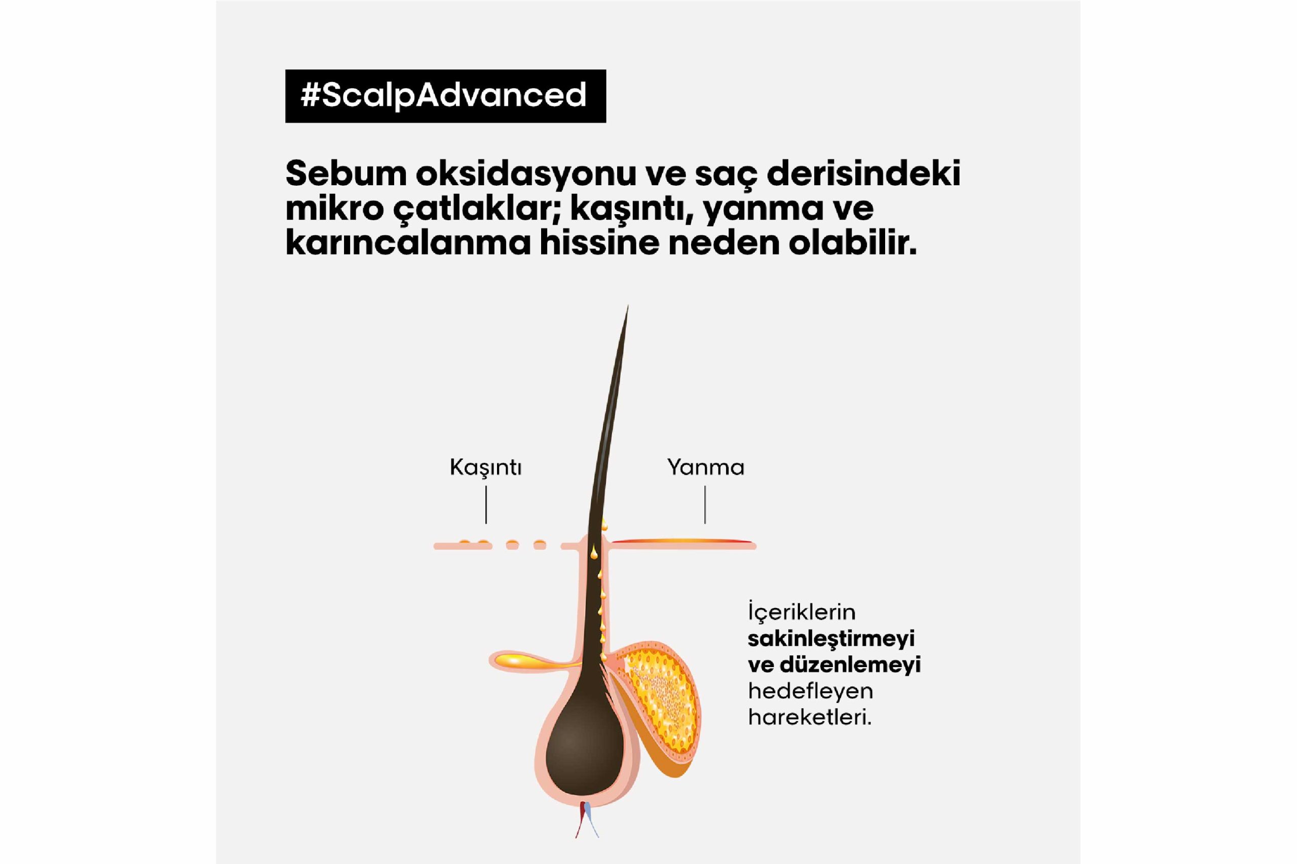 Scalp Advanced Hassas Saç Derisi İçin Profesyonel Şampuan 500ml 3 Scalp Advanced Hassas Saç Derisi İçin Profesyonel Şampuan 500ml - Görsel 3