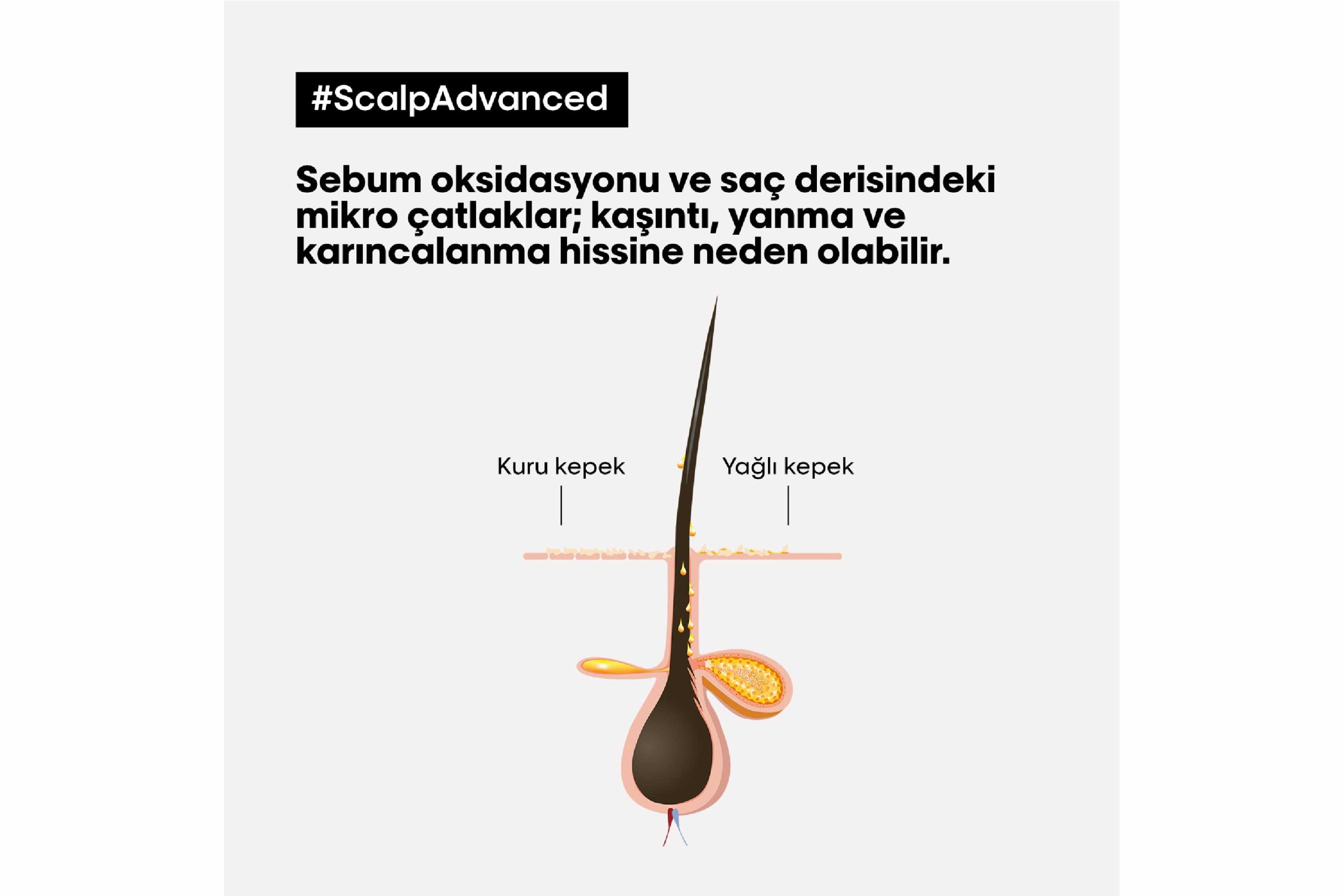 Scalp Advanced Kepek Karşıtı Profesyonel Şampuan 500ml 5 Scalp Advanced Kepek Karşıtı Profesyonel Şampuan 500ml - Görsel 5