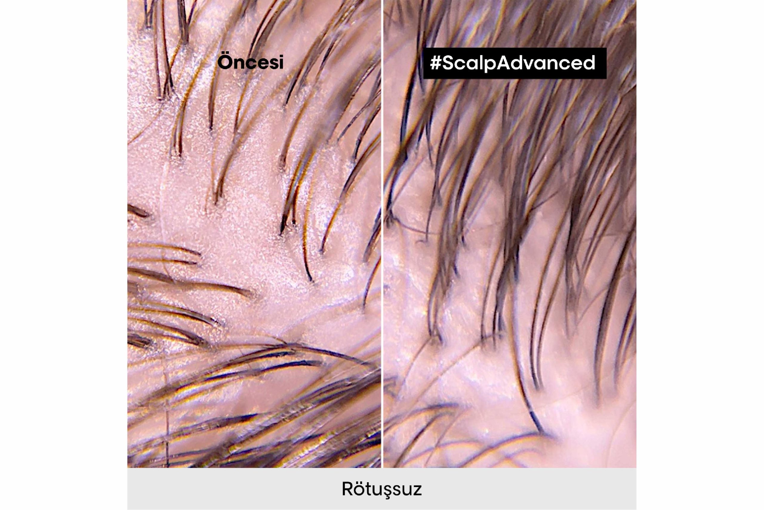 Scalp Advanced Yağlanma Karşıtı Profesyonel Şampuan 500ml 5 Scalp Advanced Yağlanma Karşıtı Profesyonel Şampuan 500ml - Görsel 5